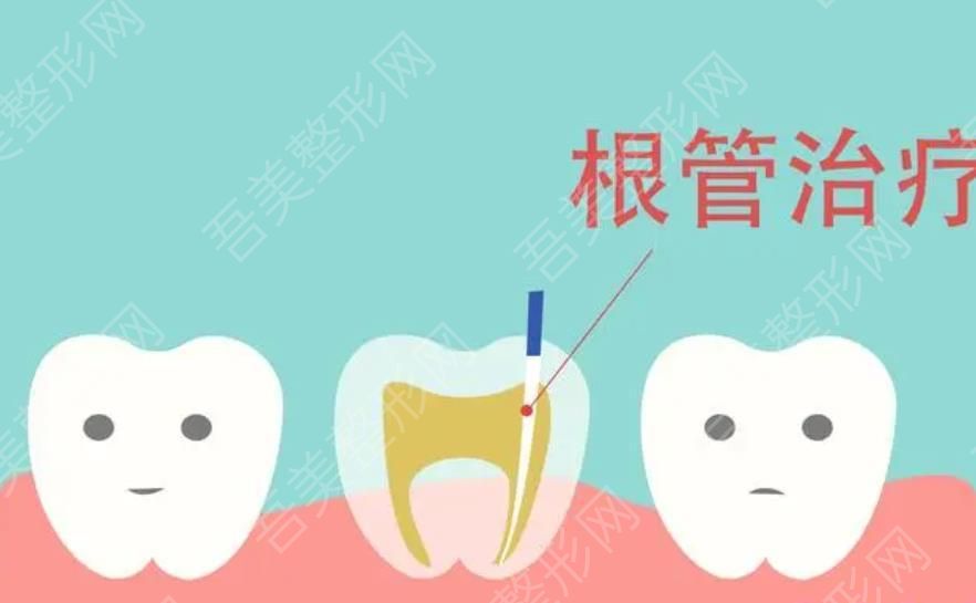 牙齿根管调节卡通图01.jpg