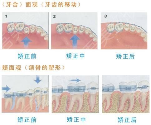 矫正过程.jpg