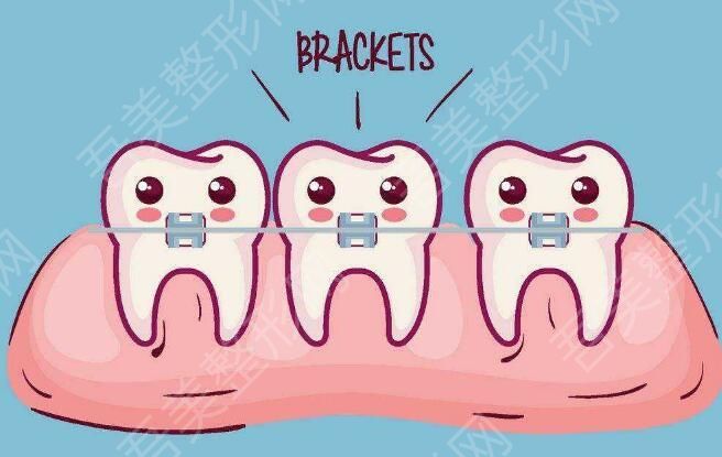 牙齿矫正17.jpg