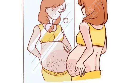 妊娠纹2.jpg
