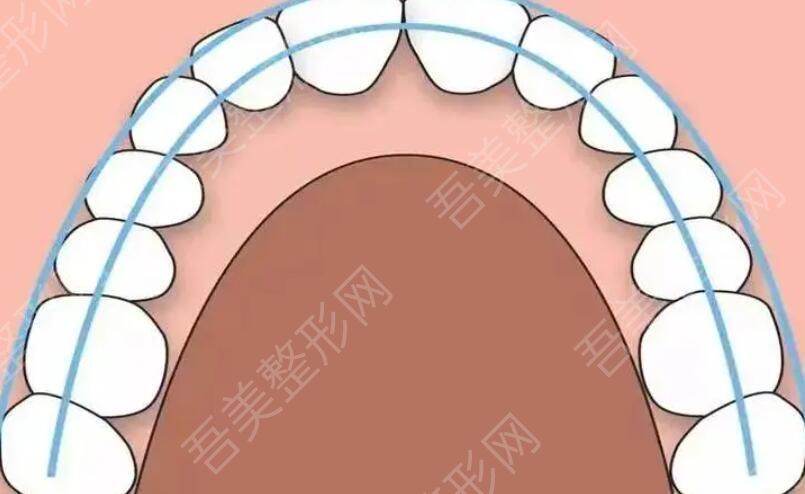 牙齿矫正动漫47.jpg