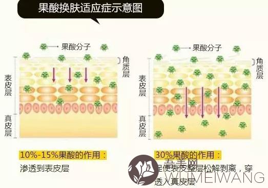 芯丝翠果酸换肤果