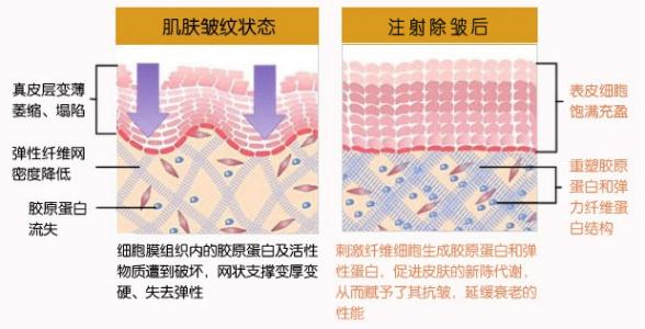 福田庆三医生科普面部除皱