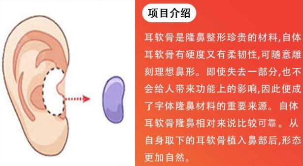 青海红十字医院美容整形科隆鼻手术科普