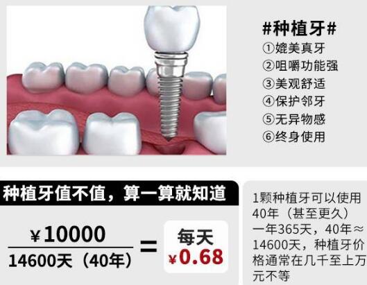 邹多宏医生科普种植牙手术知识