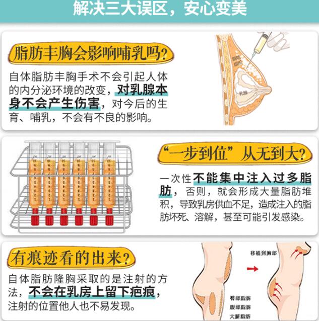 韩国korea整形医院科普胸部整形手术