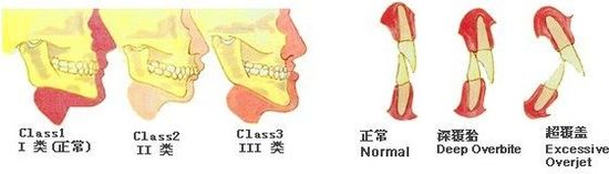 深覆合