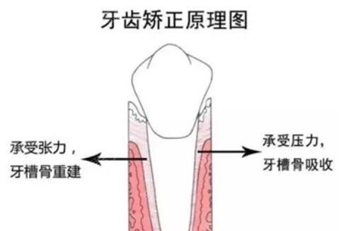 杭州市第三人民医院口腔科科普牙齿矫正