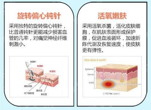 郑州芳艺整形医院科普腰腹吸脂手术相关知识