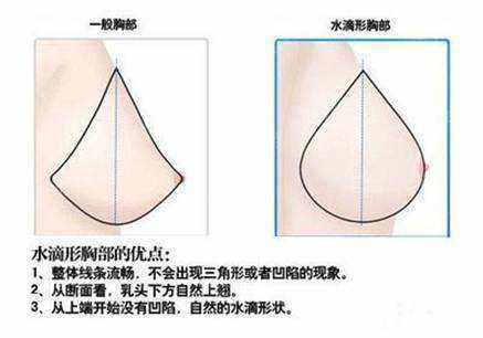 北京八大处整容医院科普隆胸手术