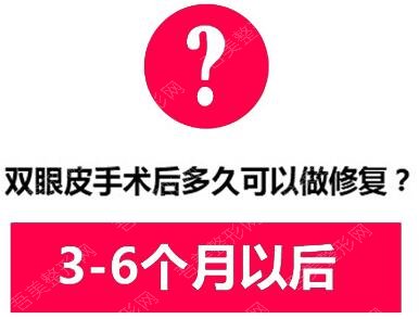 韩勋医生介绍双眼皮修复手术