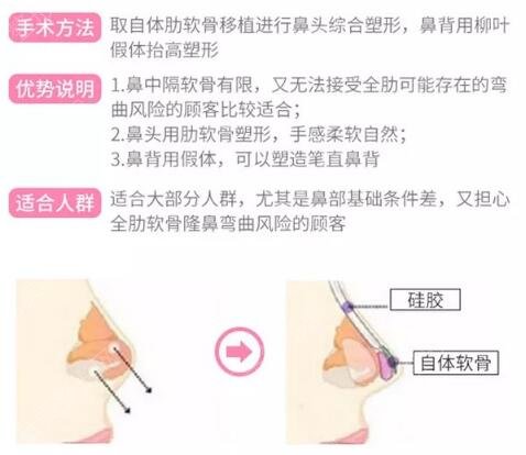 西京医院整形外科医生科普隆鼻手术