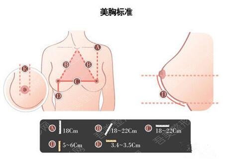 广州南方医院整形美容外科隆胸案例